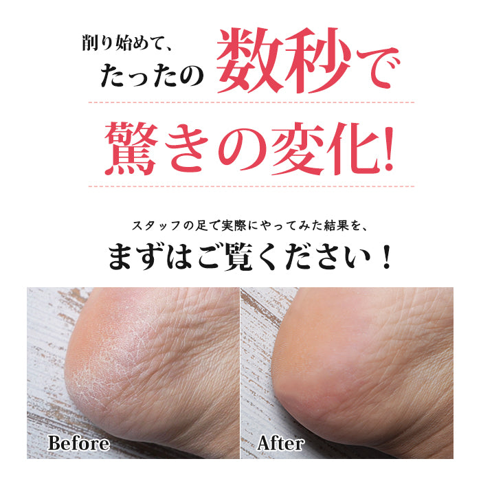 フットケアセット かかとケア かかと角質除去 フットケア – petitprice