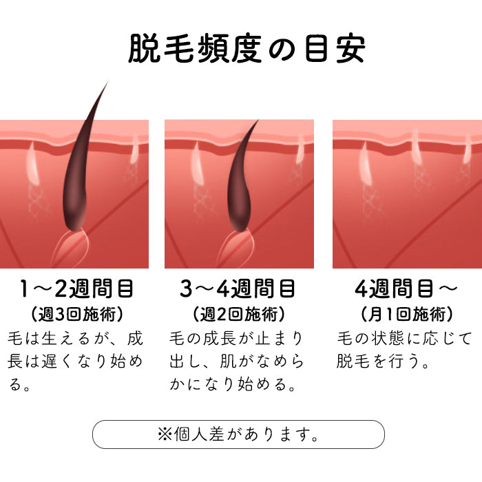 宅配便 ［Folica］脱毛器 脱毛器 家庭用脱毛器 女性用 男性用 ジェル