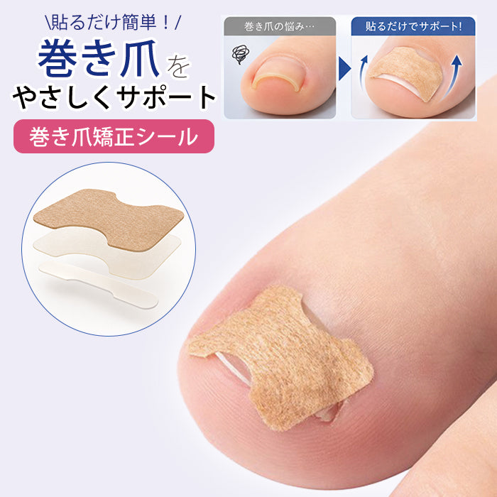 巻き爪矯正シール – petitprice