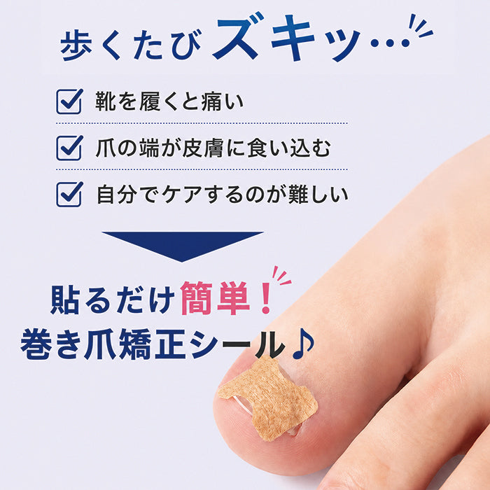 巻き爪矯正シール