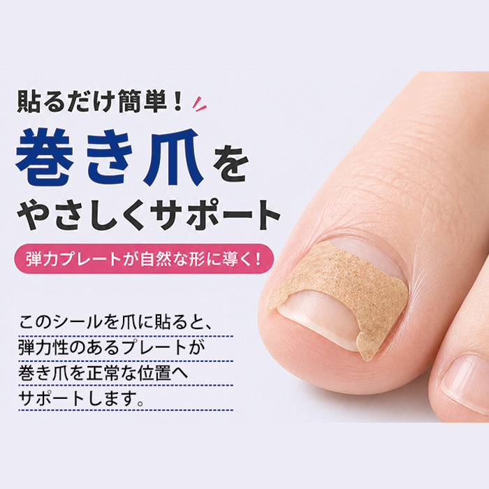 巻き爪矯正シール – petitprice