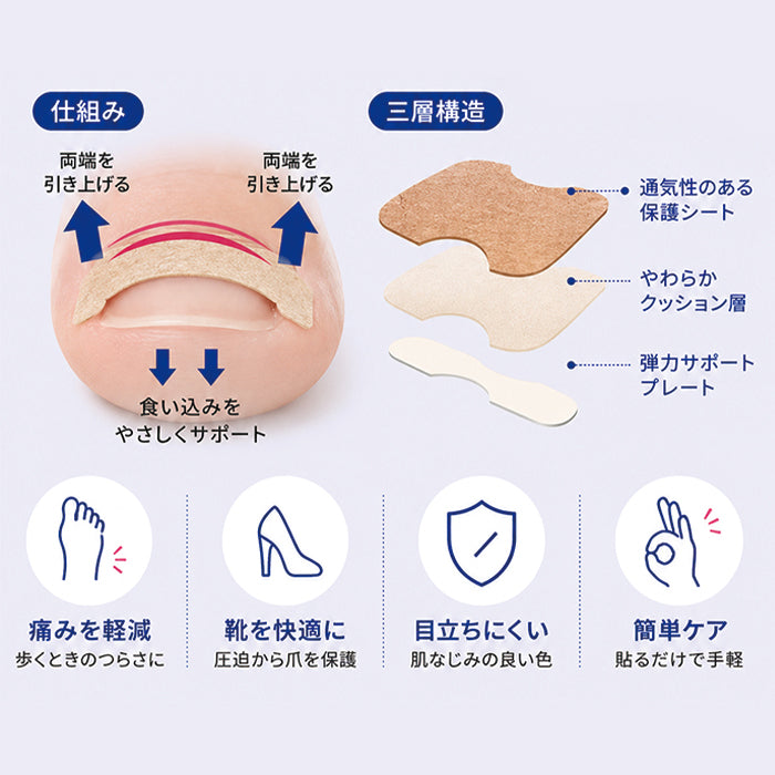 巻き爪矯正シール